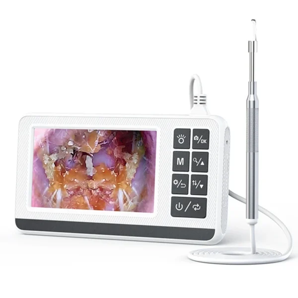 MOCC Smart Digital Otoscope - Image 4